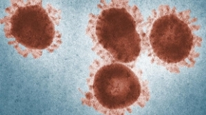 Coronaviruses, showing their characteristic spikes, which give them their characteristic “crown-like” (coronal) appearance 